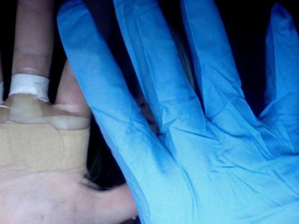 CrossFit, CrossFit Games, CrossFit Games Regionals, CrossFit Games Southwest Regionals, Smashby Training, Jaelyn Wolf, Hand Tear, CrossFit Hand Tear